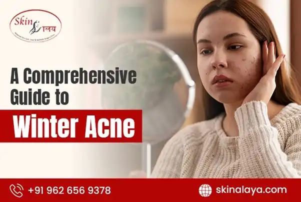A Comprehensive Guide to Winter Acne