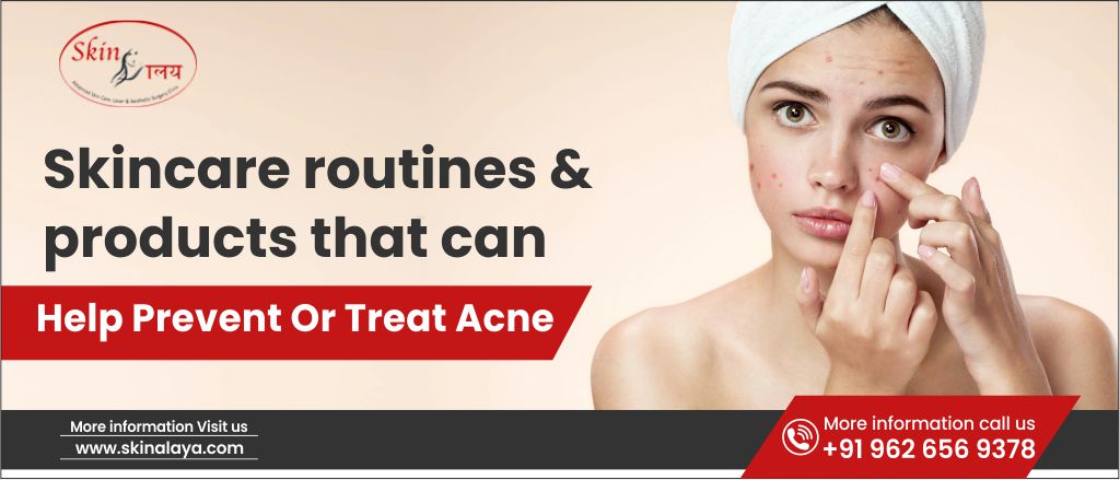 Skincare routines and products that can help prevent or treat acne
