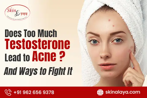 does-too-much-testosterone-lead-to-acne-and-ways-to-fight-it.php
