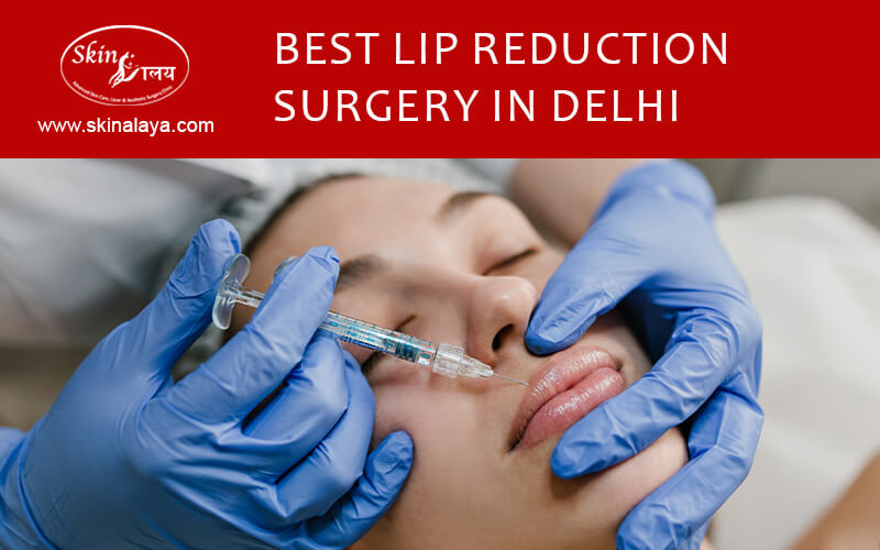Best Lip Reduction surgery in Delhi